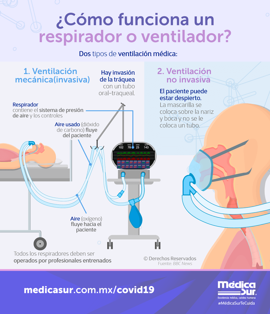 ¿Cómo funciona un respirador o ventilador?